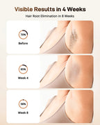 EVUREA Ice Pro — At-Home IPL Hair Removal with Ice Cooling