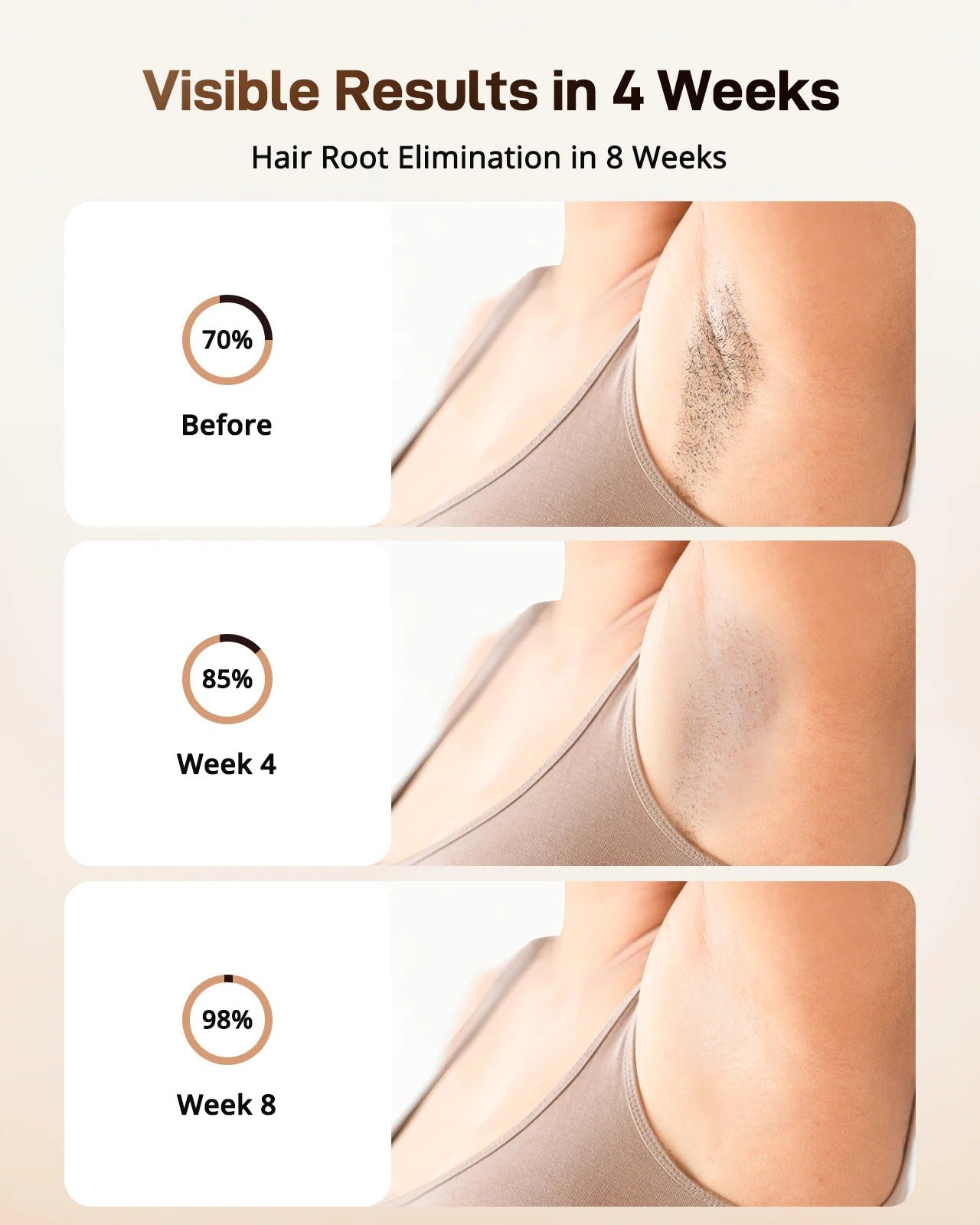 EVUREA Ice Pro IPL Hair Removal Device